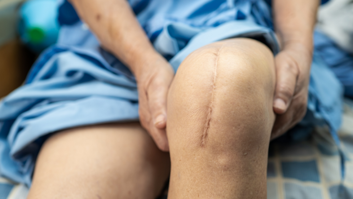 Narben und Trauma - Blog